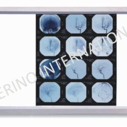 X-Ray-Viewer-1-250x250