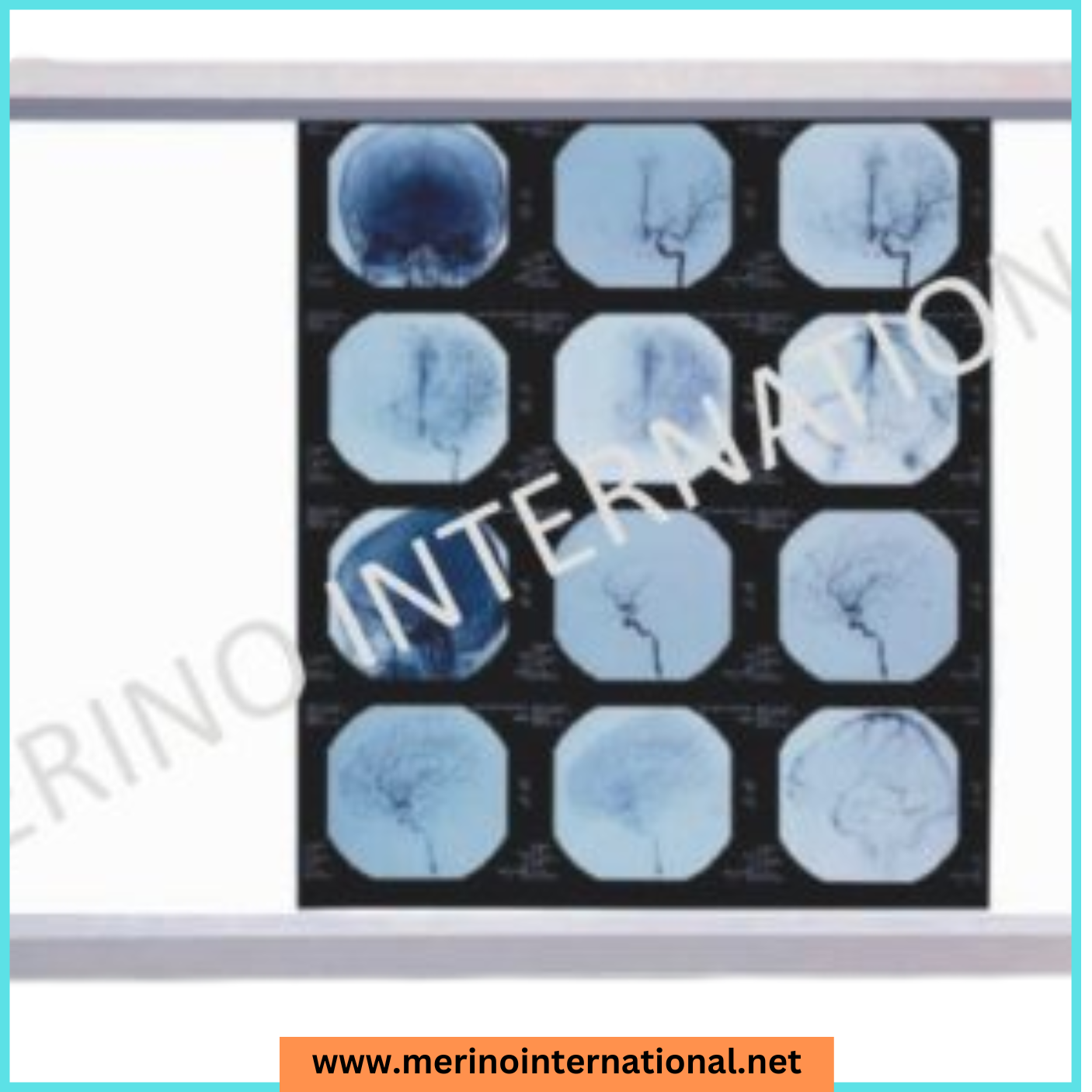 Economical Version LED XRAY View Box