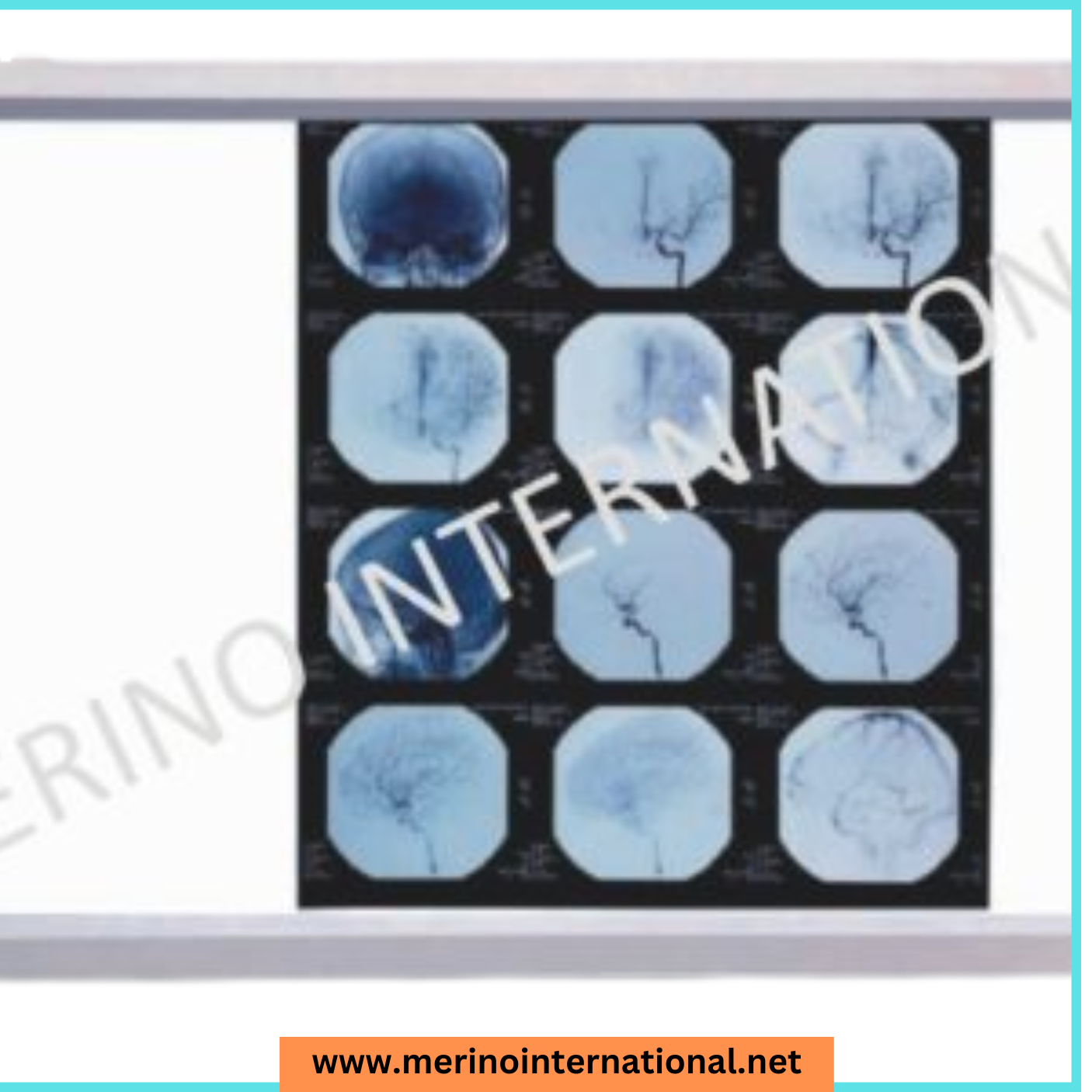 Economical Version LED XRAY View Box